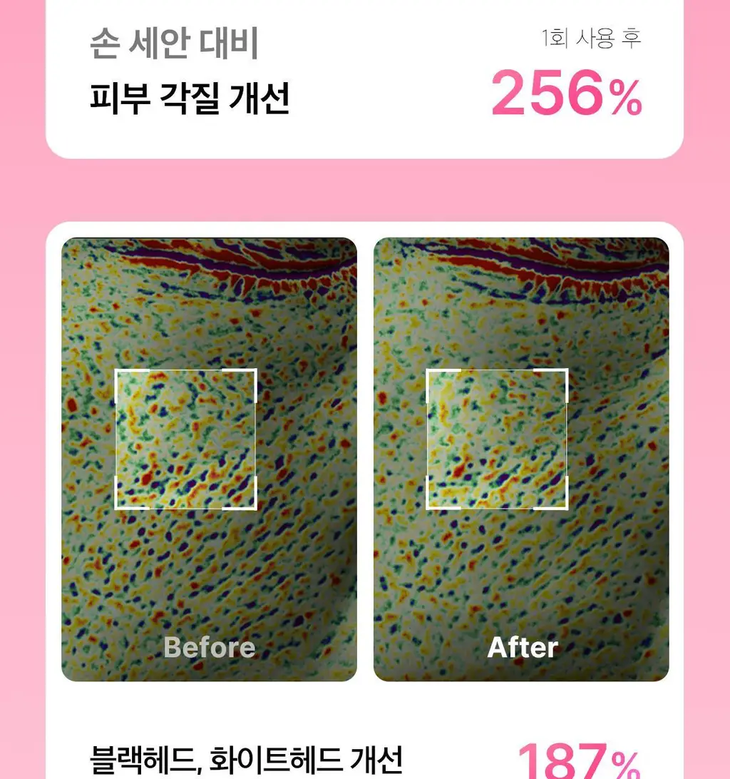 [3D진동클렌징/모공케어] 메디큐브 에이지알 부스터 진동 클렌저 헤드 (베이지/핑크) 상세페이지 26